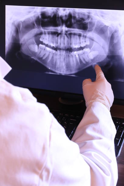 Best Emergency Tooth Extraction in Garrett, WA